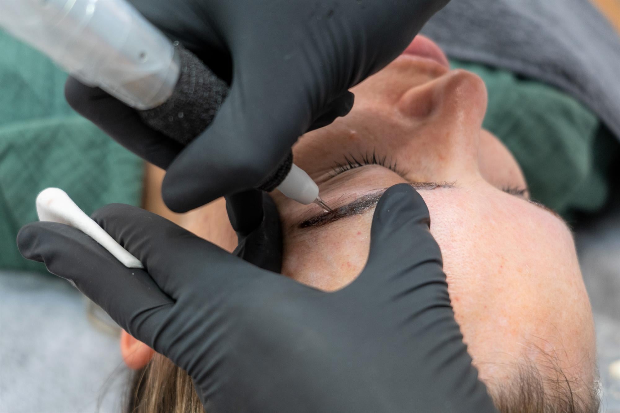 Cosmetic Tattoo Removal