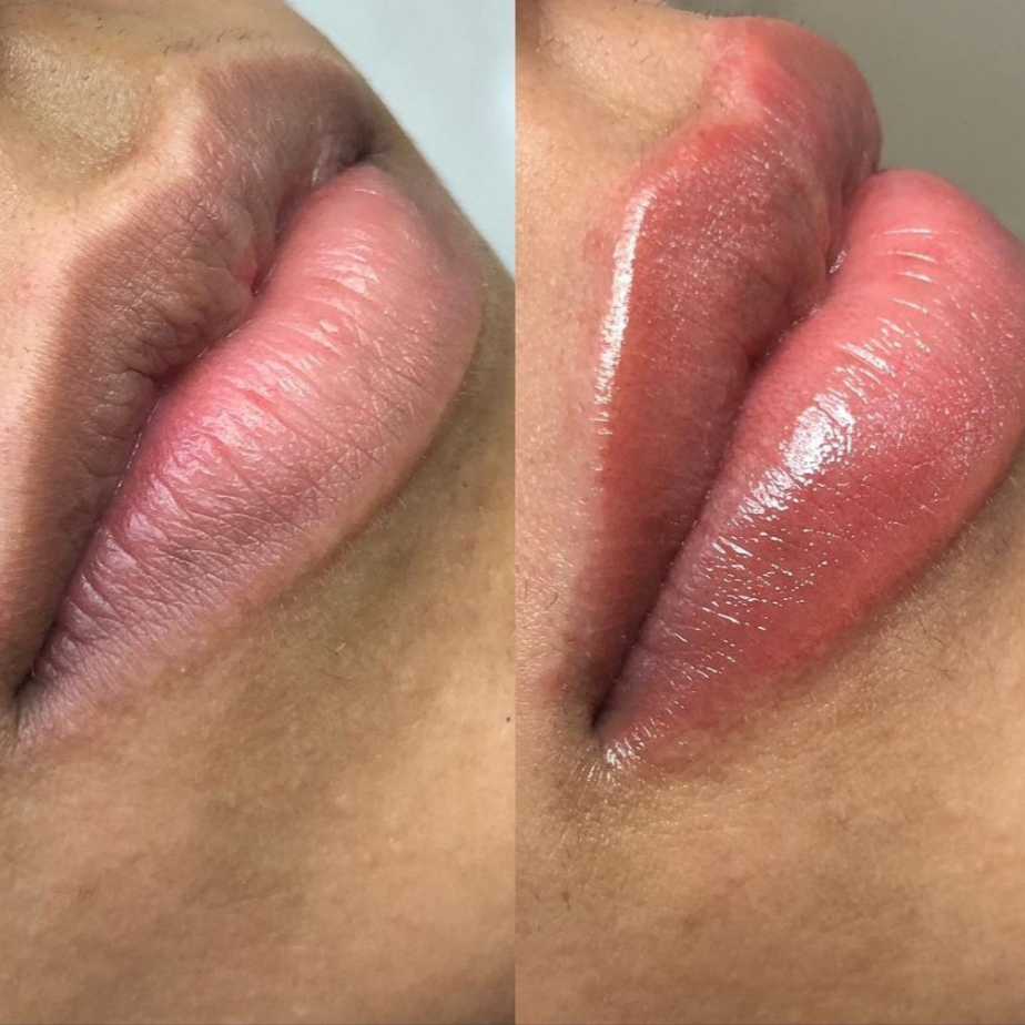 Lip Lightening