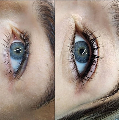 Lash Enhancement