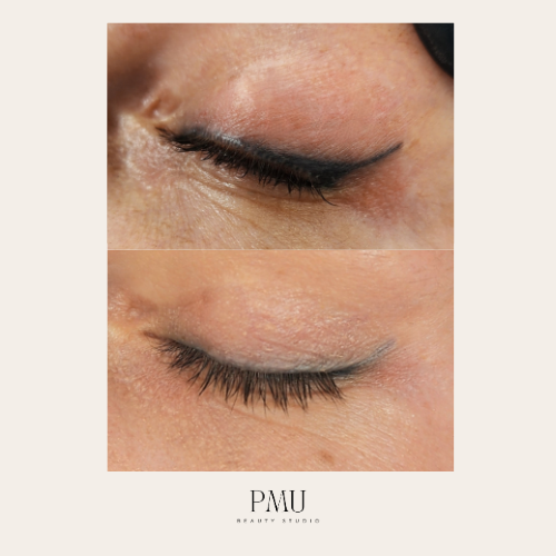 eyeliner removal PMU Beauty Studio