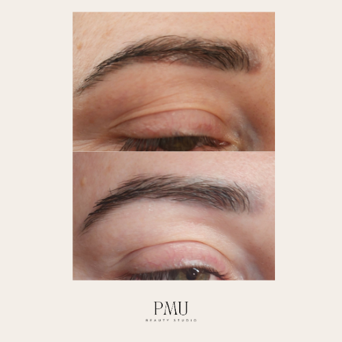 Before-and-after comparison of eyebrow removal