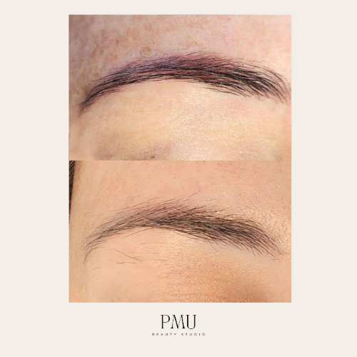 Auckland eyebrow tattoo removal