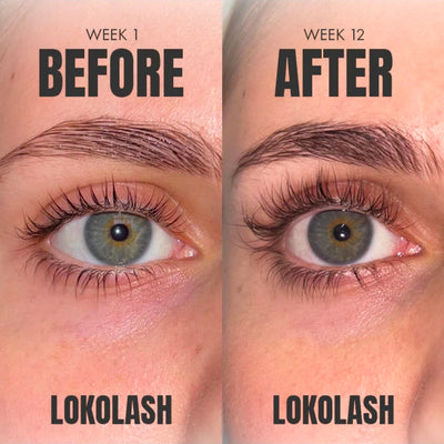 Lokolash Serum